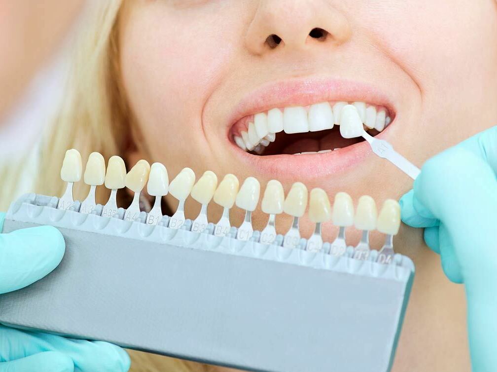 Стоматологический центр «Стоматолог и Я» предлагает отбеливание зубов при помощи системы ZOOM4