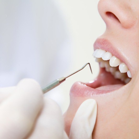 Специалисты центра «Стоматолог и я» рассказывают о появлении трещин на зубах